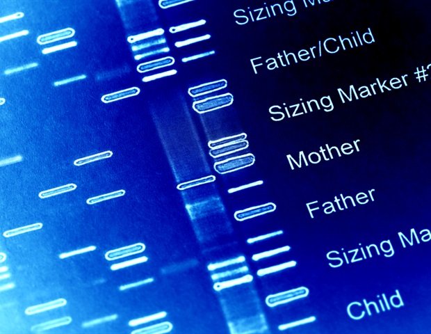 Healthy lifestyle lowers risk of diverticulitis despite genetic susceptibility